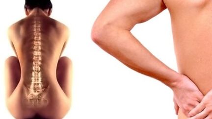 Dor nas costas na rexión lumbar