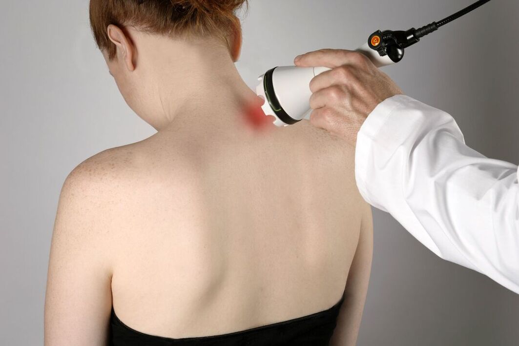 tratamento de fisioterapia da osteocondrose cervical