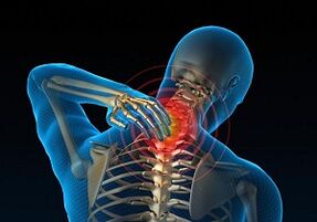 Por que se desenvolve e como se manifesta a osteocondrose cervical